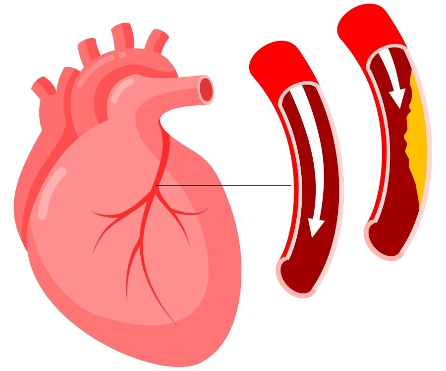 Collagen May Buoy Your Heart Health